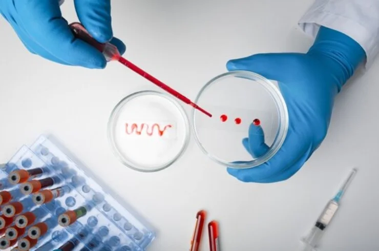 Serology